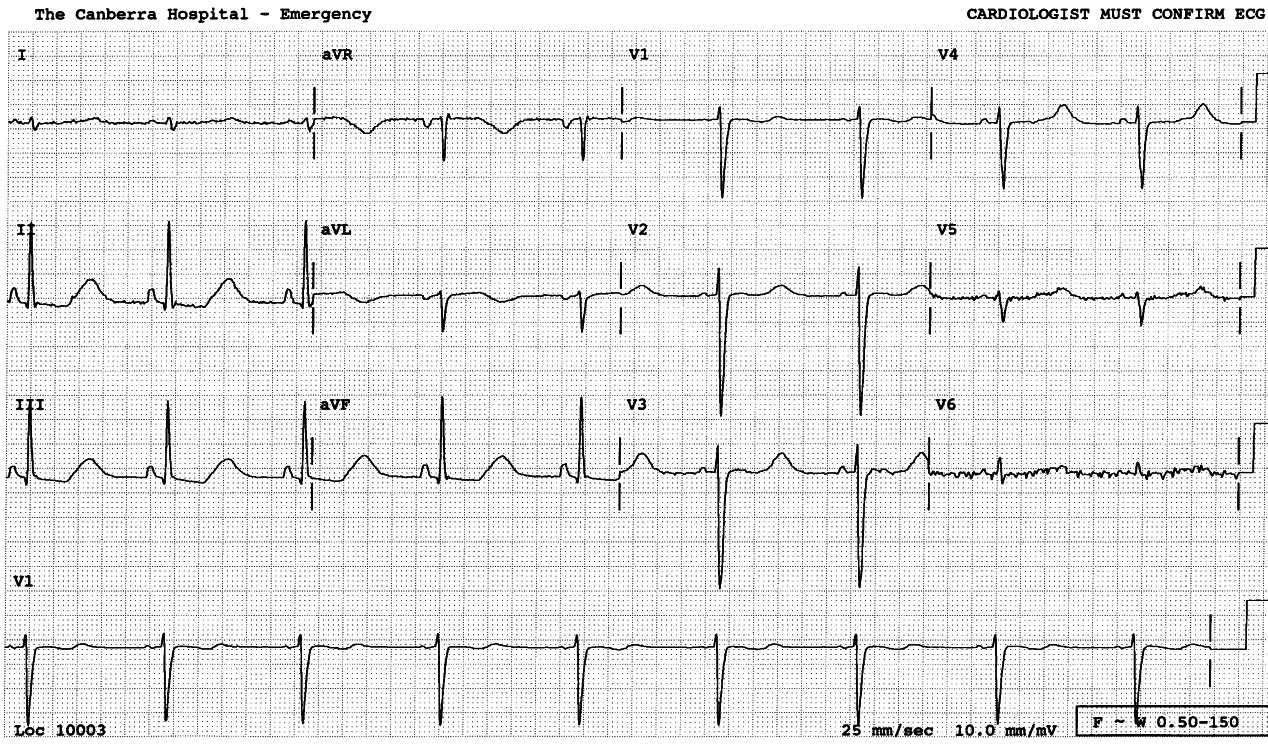 32 year old man abusing laxatives to purge his ârectal valves and crypts of LieberkÃ¼hnâ.