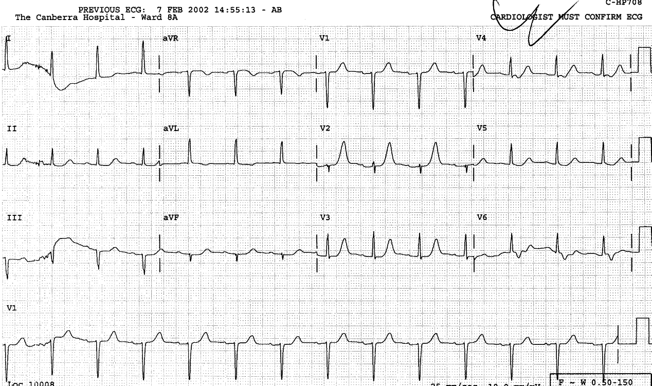 71 year old lady with mild but chronic renal failure