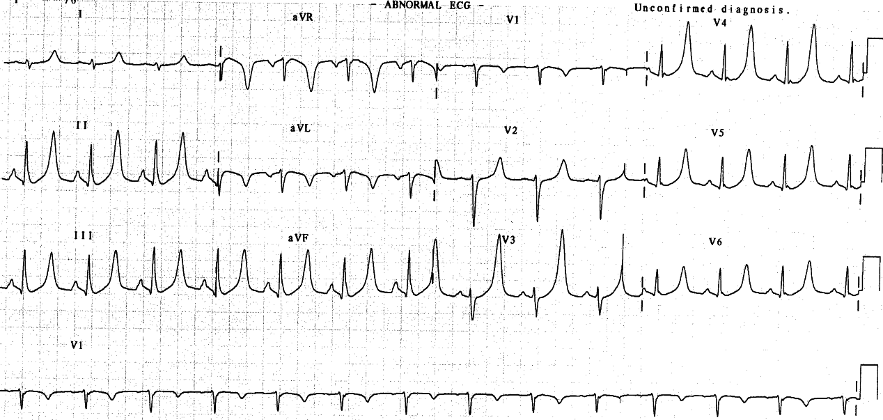 20 year old lady, about to become an organ donor following a traffic accident