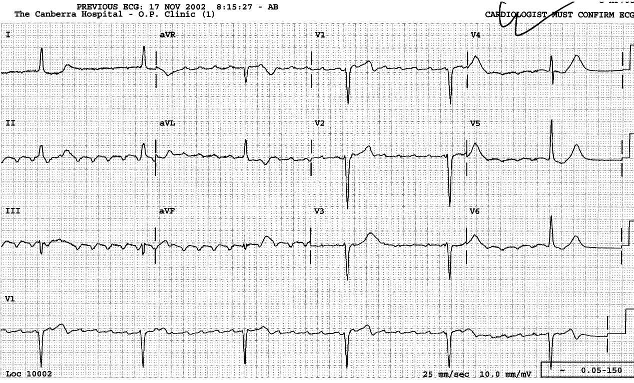 Same patient as Case 81, five days later. 