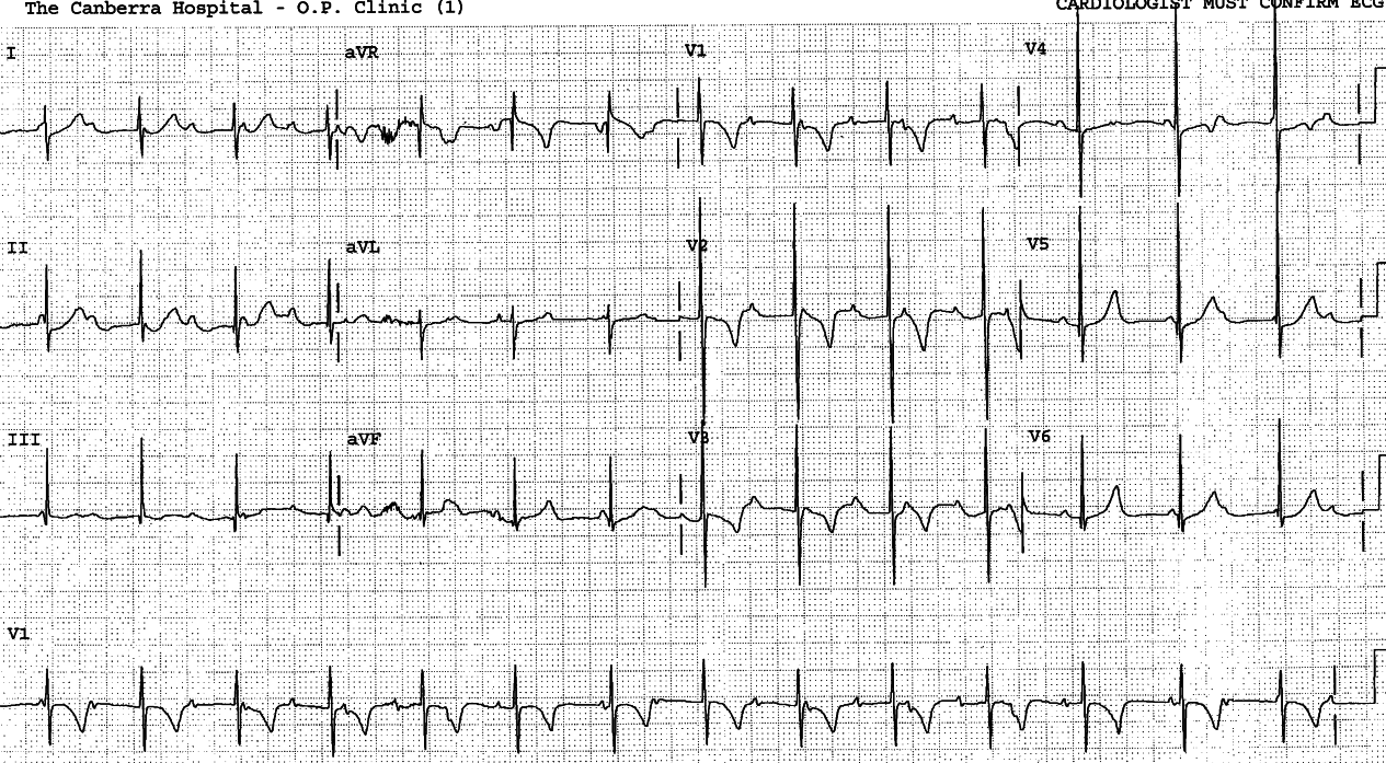 Same patient at the age 4 months. 