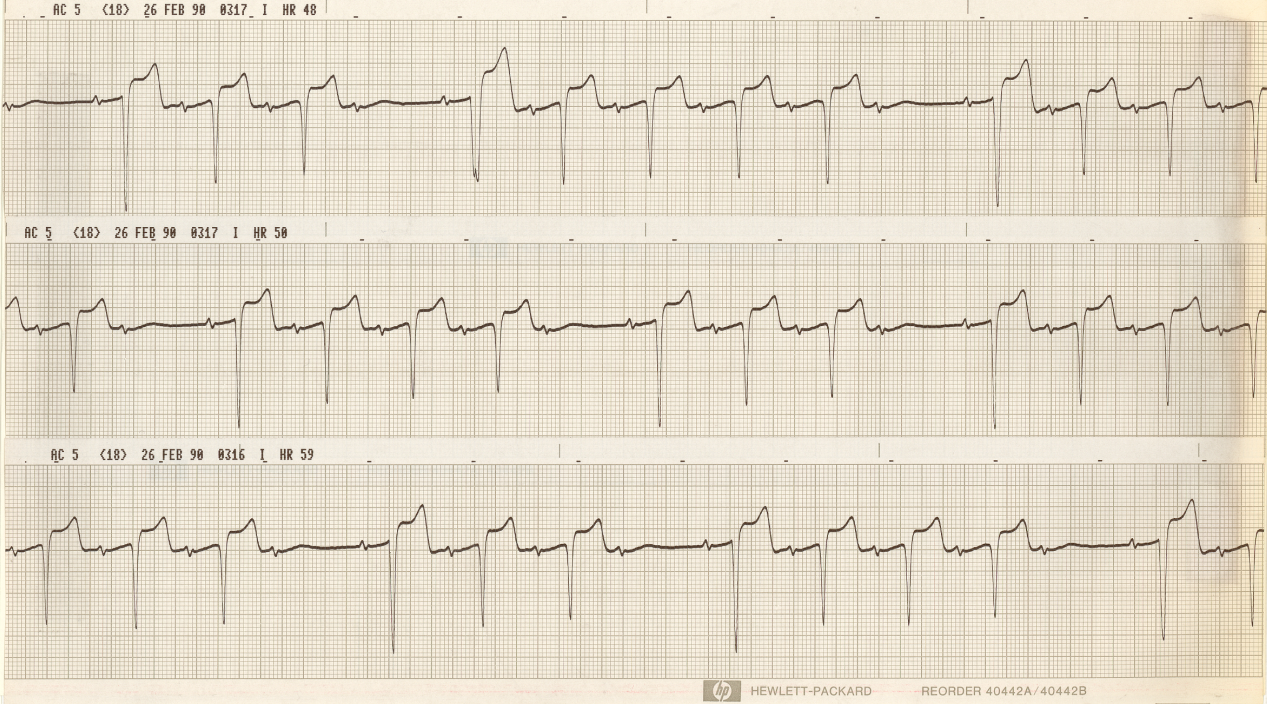 Some complexes are different. Why? 