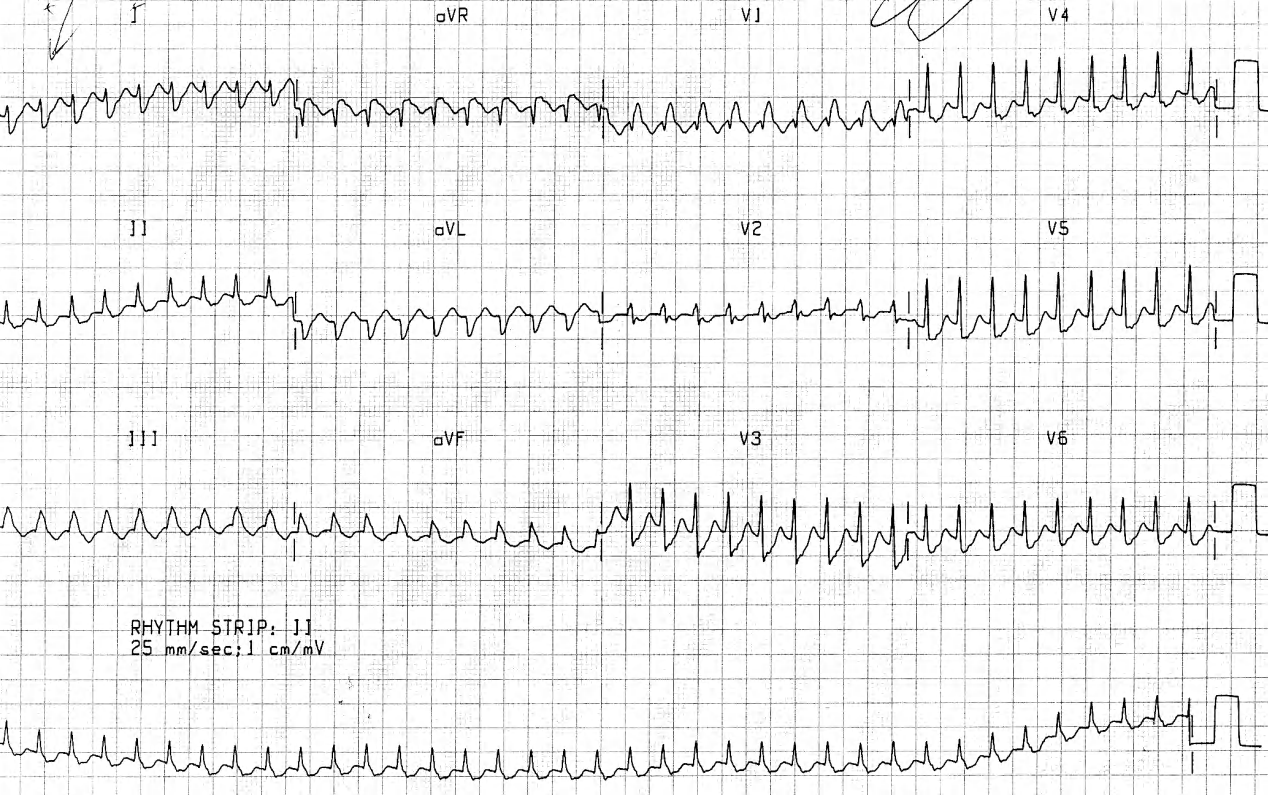 29 year old woman feeling faint and funny in Casualty, where she was well known. 