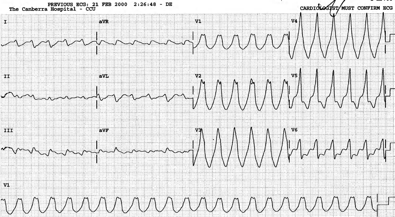 Uniform VT. 