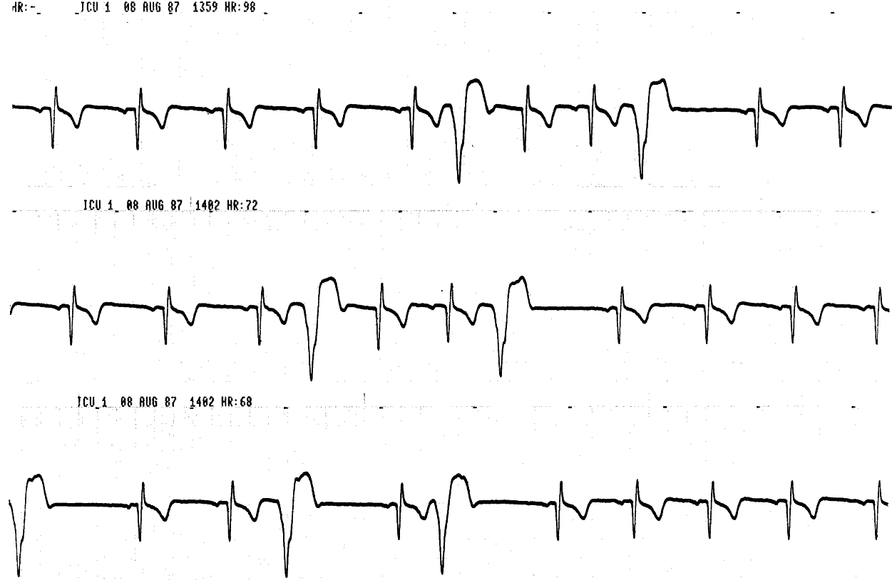 Routine postoperative monitoring of a young man with wired jaws,     concealing something to an uncommon degree. 