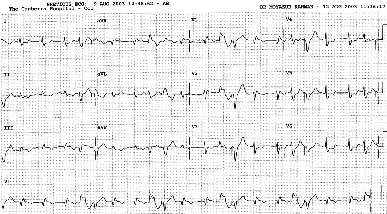 81 year old lady with permanent pacemaker. Who is married to
whom?