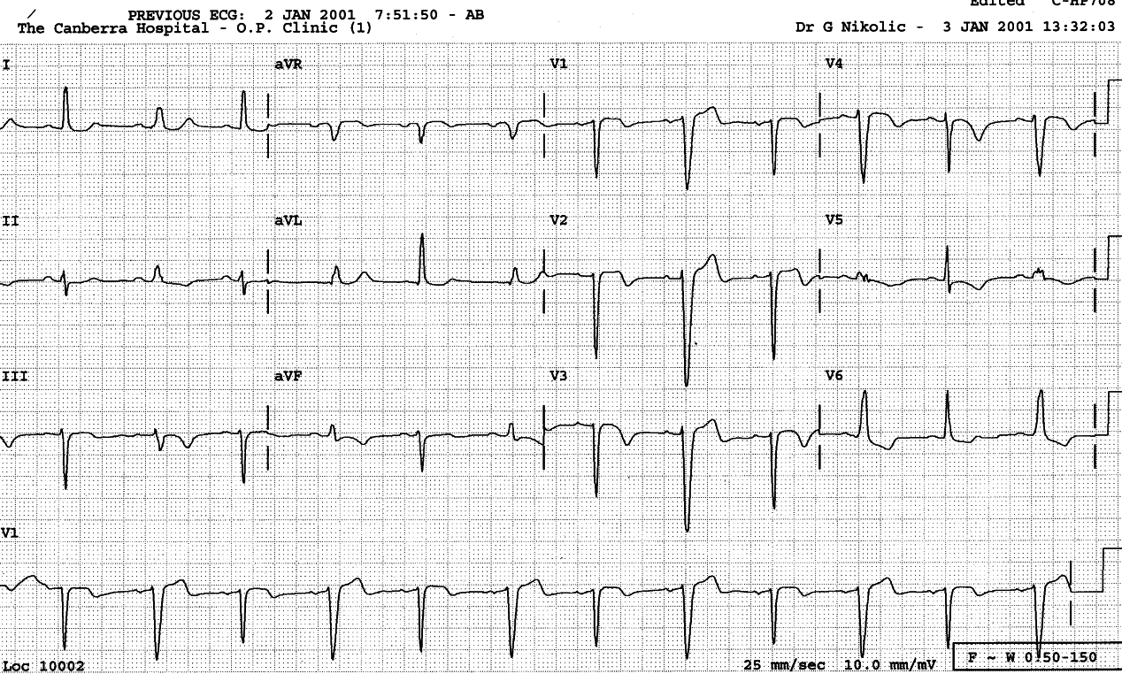 Same patient, 24 hours later.