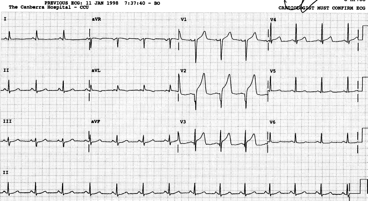 Same 41 year old, three days later, with recurrent and persistent pain.