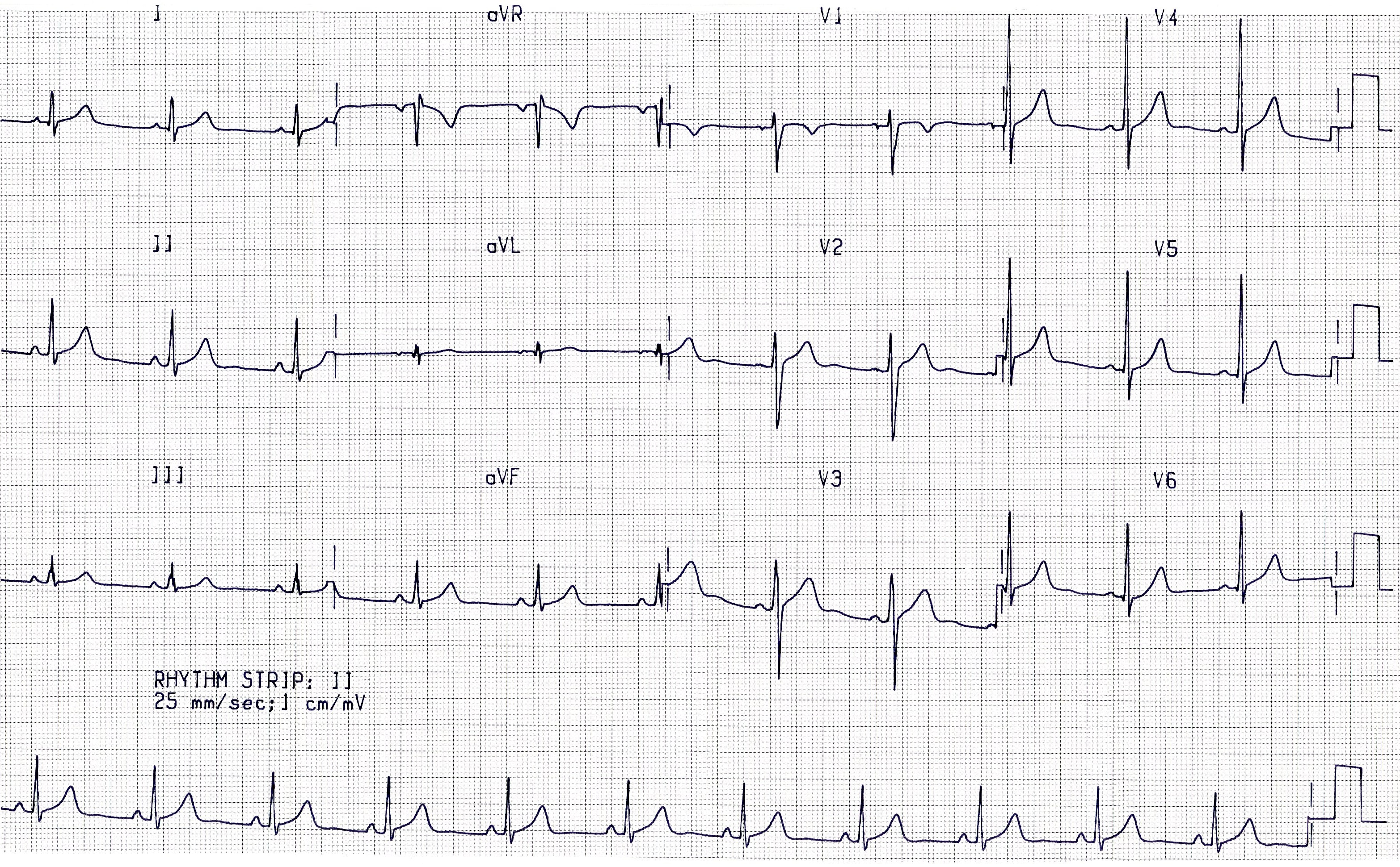 29 year old ICU Registrar, idle during a quiet night shift