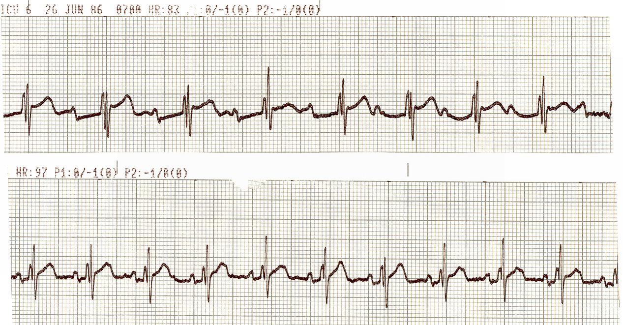 Another example from the same patient.