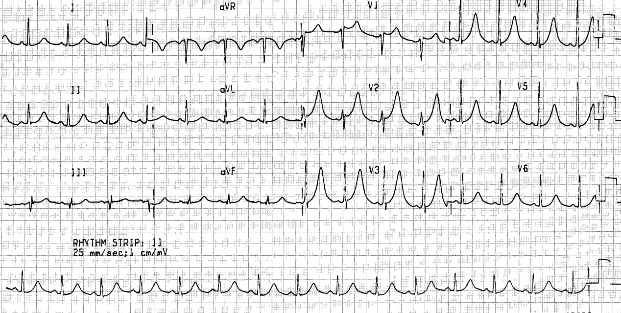 46 year old man found unconscious at home