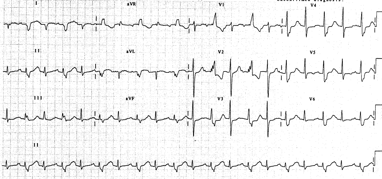 57 year old lady with unexplained neurological symptoms