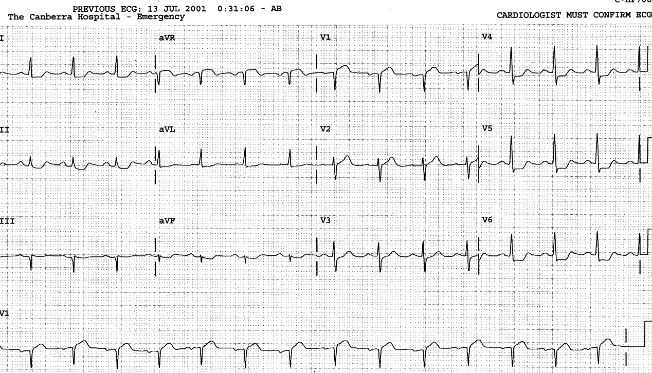 65 year old man with chest pain in Casualty.