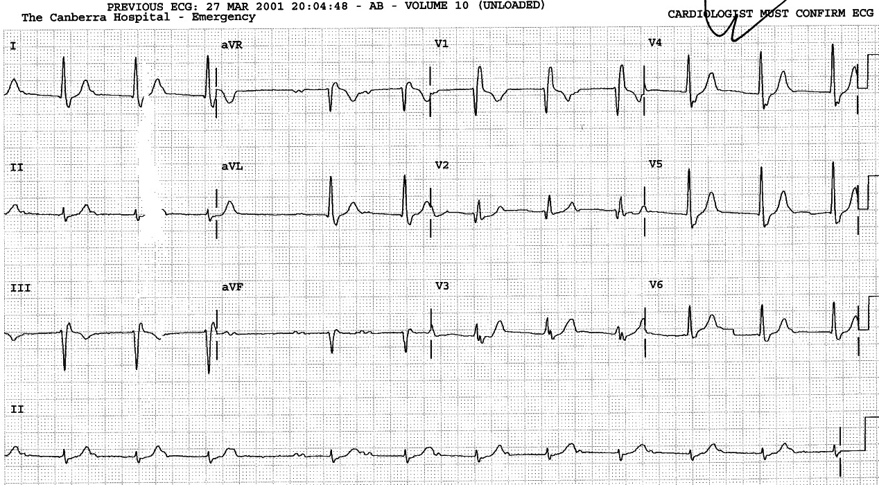 LAA and four other blocks.