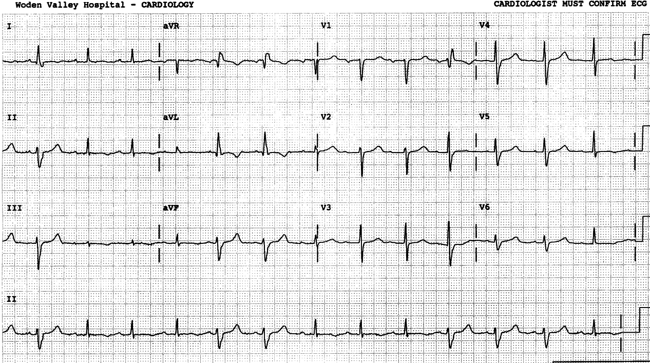 54 year old man with chronic renal failure.