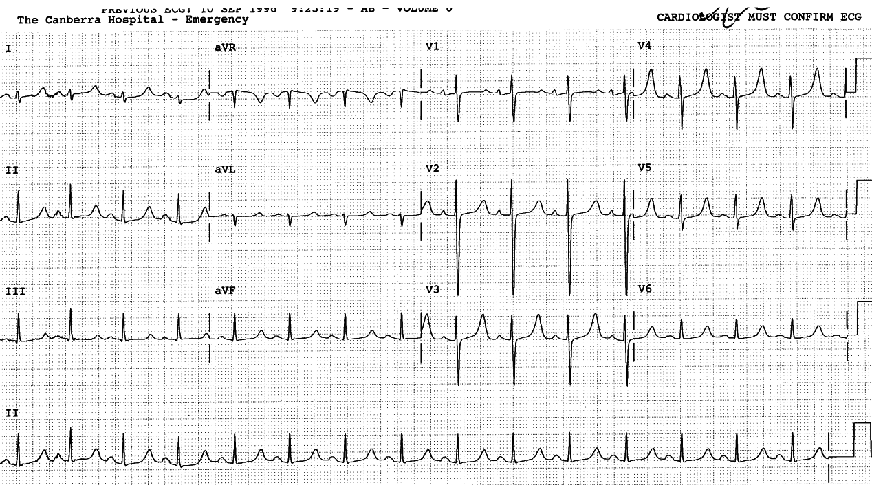 An example, too, of a âvertical heartâ.