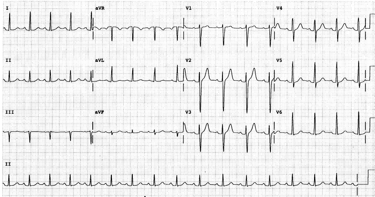 40 year old man with chest and trapezius ridge pains