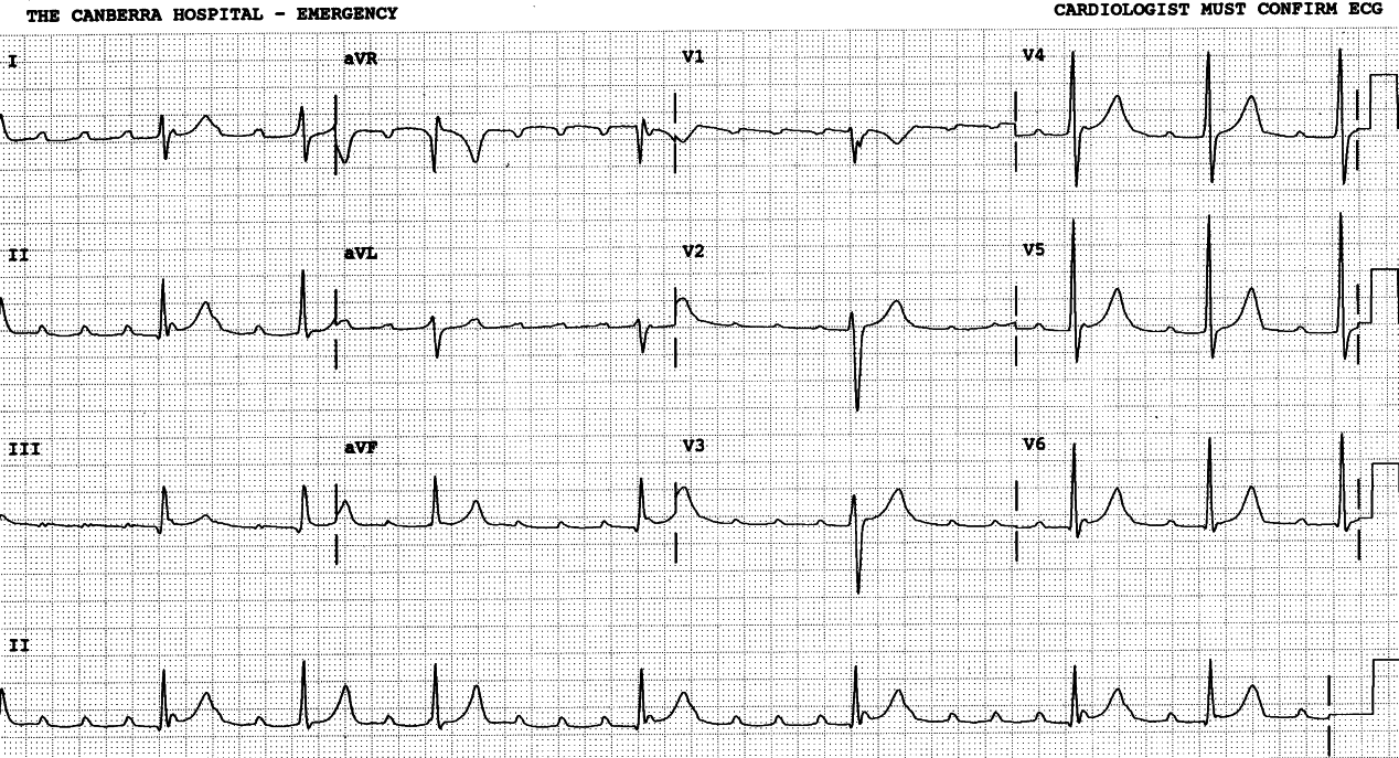 Odd conduction ratios throughout. 