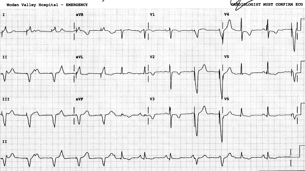 73 year old man in Casualty with chest pain.