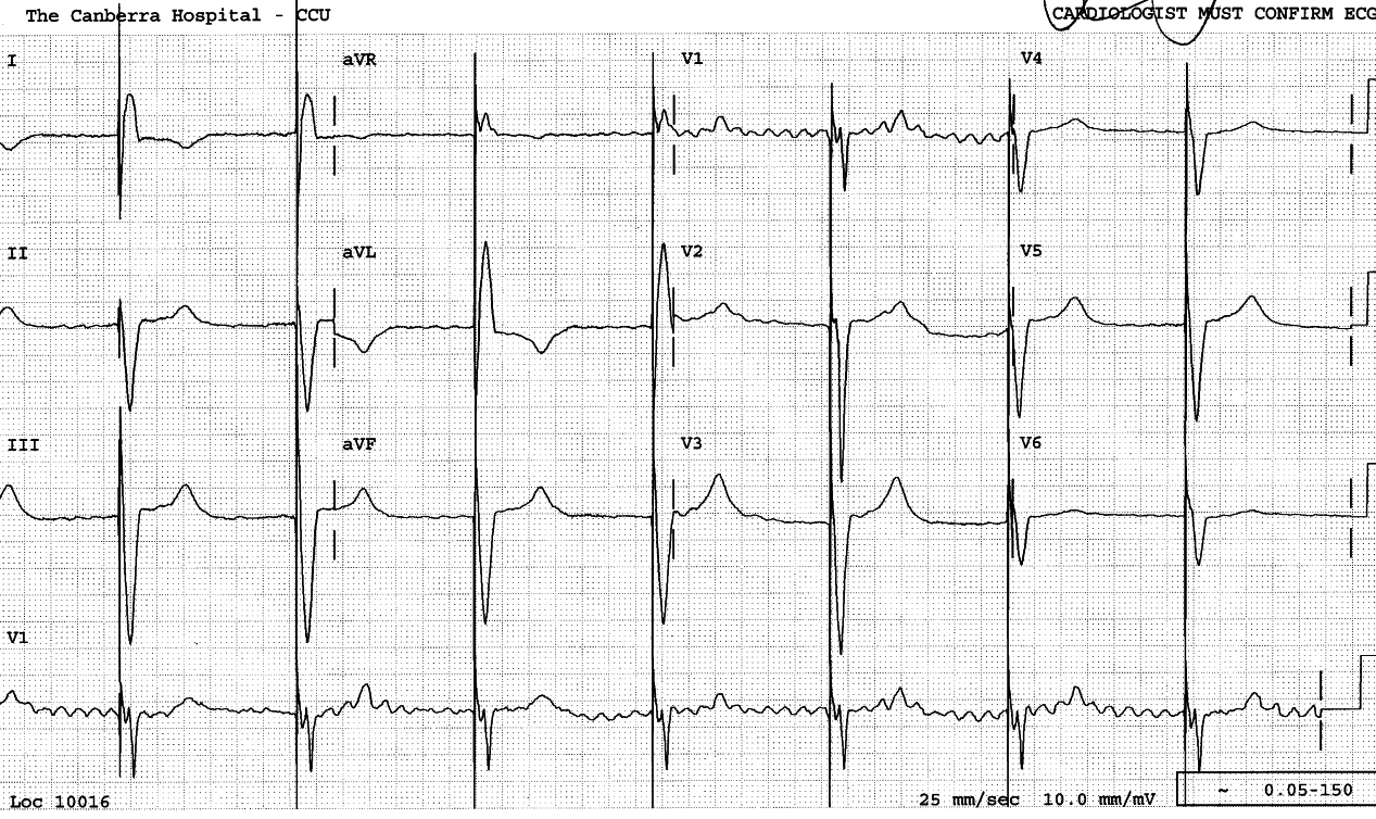 88 year old man, confused and
hypotensive.