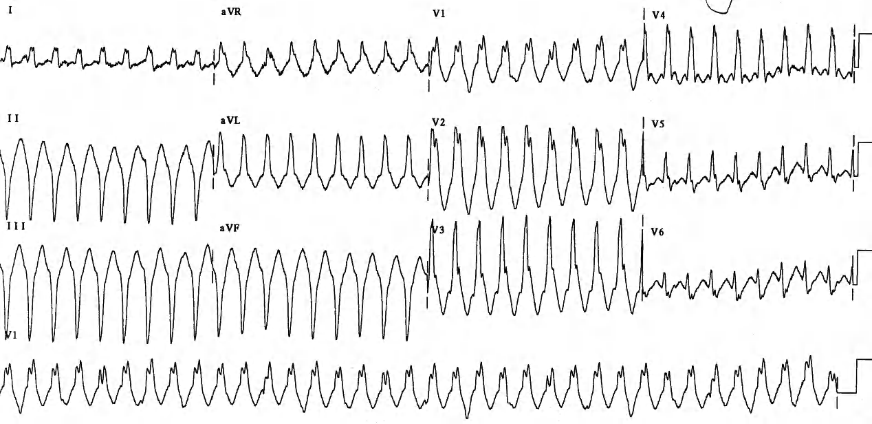 58 year old man in Casualty, distressed but unable to describe it. 