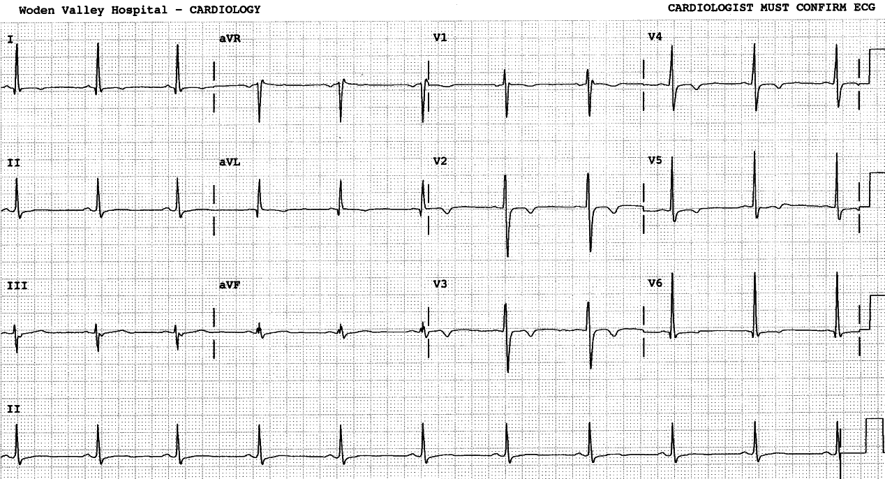 30 year old man with pleuritic chest pains over the past two weeks