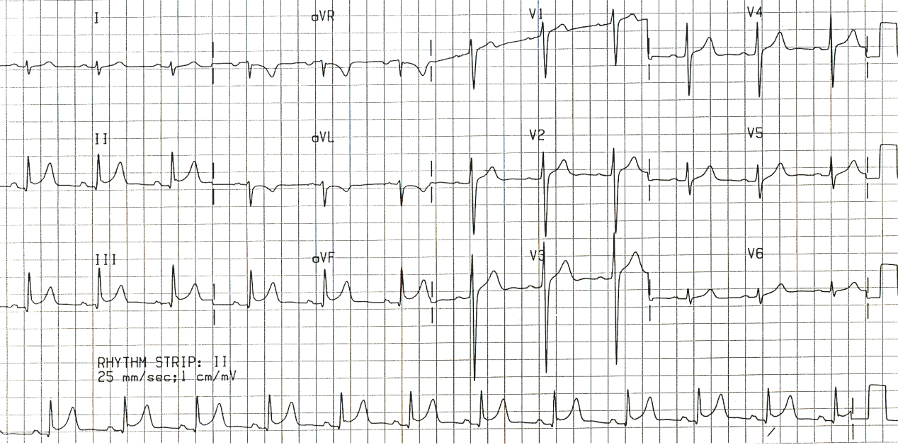 Physically healthy 23 year old following a minor sedative overdose