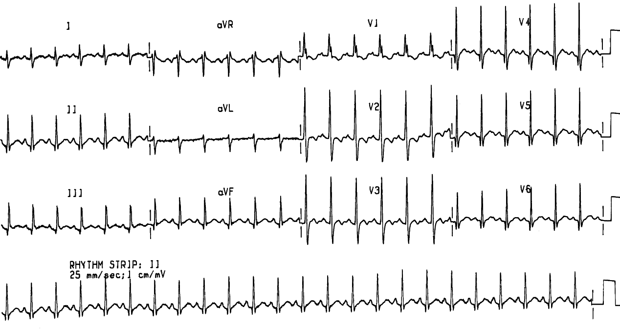 10 year old child with advanced myopathy. Can you tell its gender?