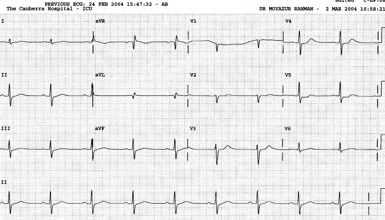 Six hours later, after stenting: a happy ending. 