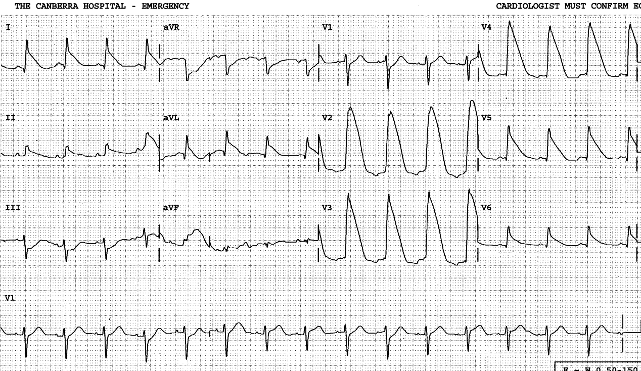 32 year old man resuscitated from drowning.