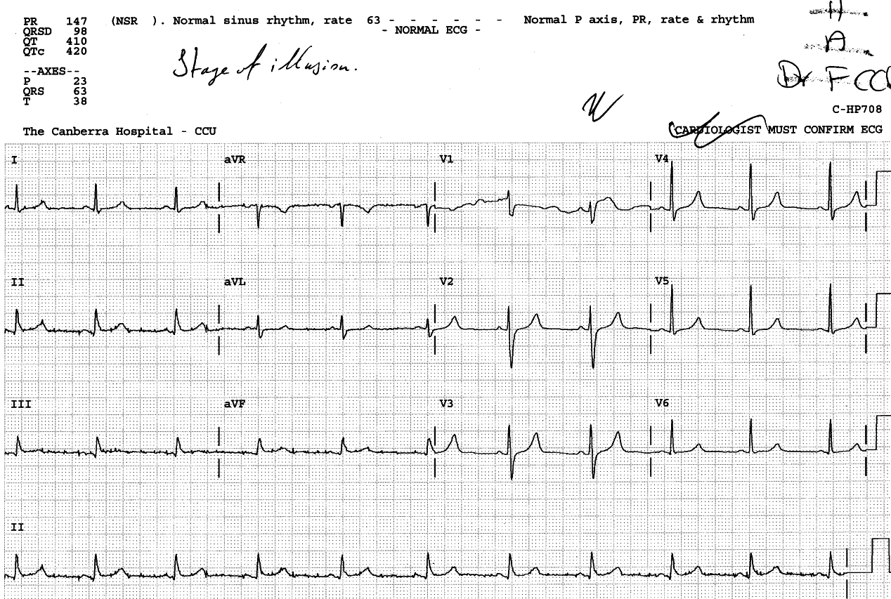 50 year old man admitted three hours previously with (now settled) chest pain.